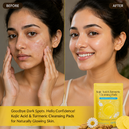Kojic Acid Glow Cleansing Pads | Dark Spot Remover & Brightening Formula