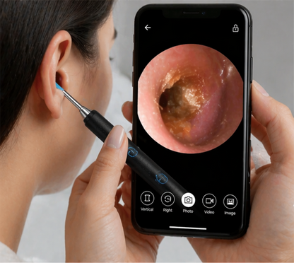SmartVision EarScope - HD Visual Ear Wax Cleaning Kit