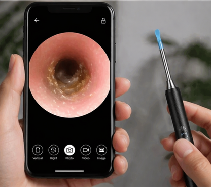 SmartVision EarScope - HD Visual Ear Wax Cleaning Kit